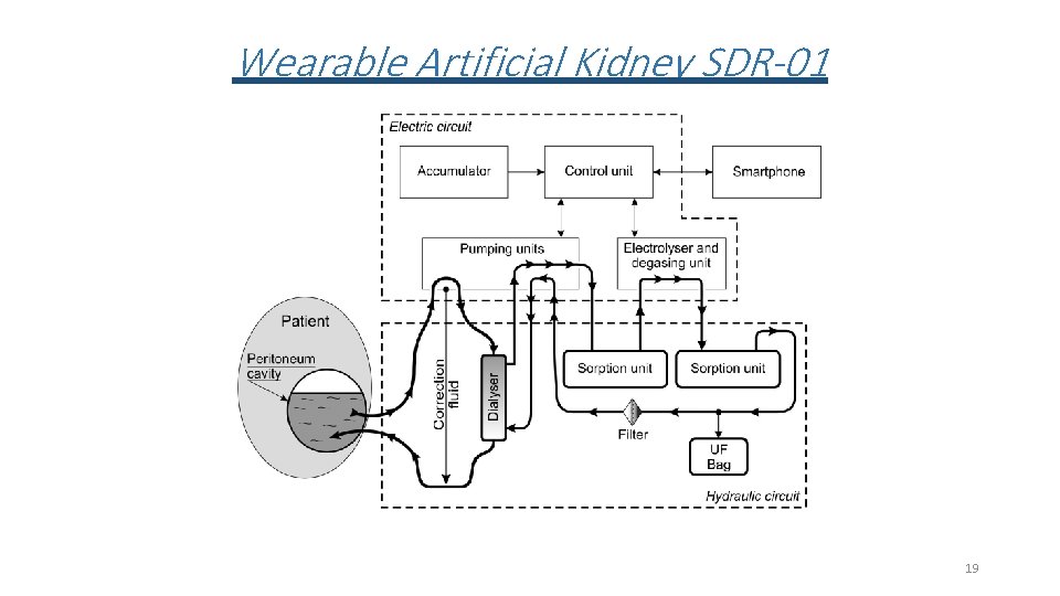 Wearable Artificial Kidney SDR-01 19 