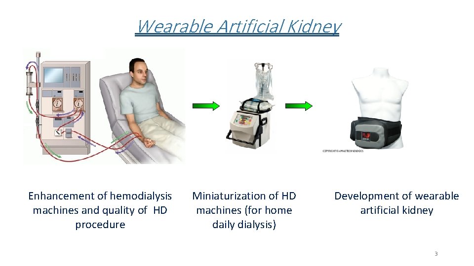Wearable Artificial Kidney Enhancement of hemodialysis machines and quality of HD procedure Miniaturization of