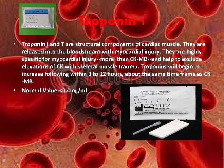 Troponin 1 • Troponin I and T are structural components of cardiac muscle. They Troponin 1 • Troponin I and T are structural components of cardiac muscle. They