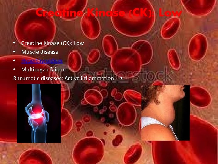 Creatine Kinase (CK): Low • Muscle disease • Hyperthyroidism • Multiorgan failure Rheumatic diseases: