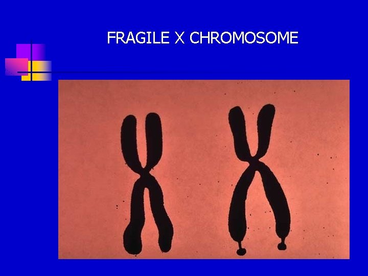 FRAGILE X CHROMOSOME 