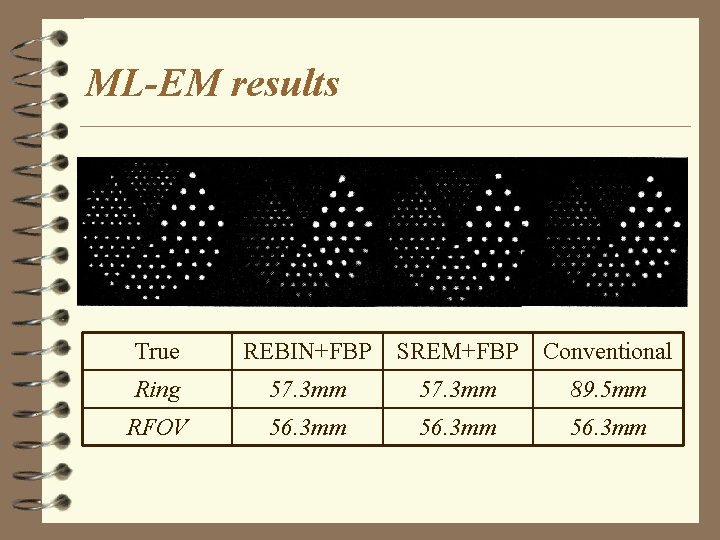 ML-EM results True REBIN+FBP SREM+FBP Conventional Ring 57. 3 mm 89. 5 mm RFOV