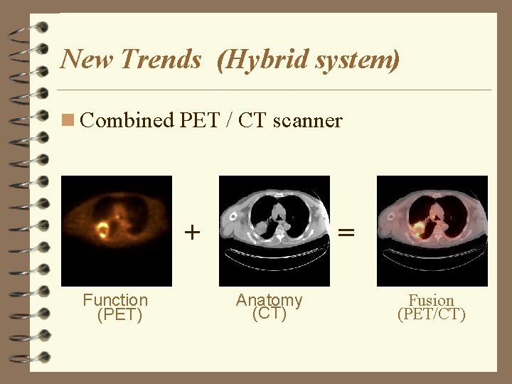 New Trends (Hybrid system) n Combined PET / CT scanner + Function (PET) =