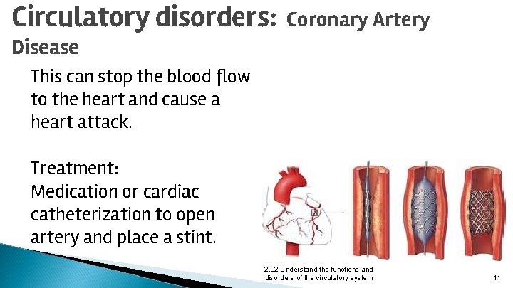 Circulatory disorders: Coronary Artery Disease This can stop the blood flow to the heart
