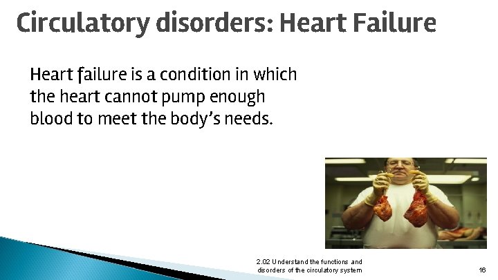 Circulatory disorders: Heart Failure Heart failure is a condition in which the heart cannot