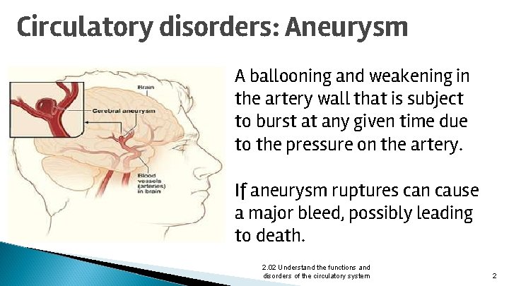 Circulatory disorders: Aneurysm A ballooning and weakening in the artery wall that is subject