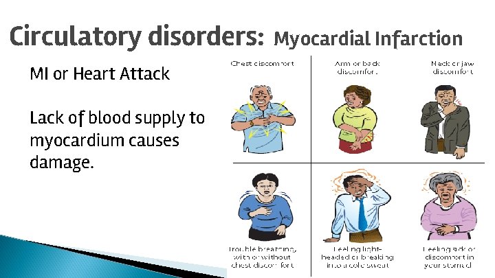 Circulatory disorders: Myocardial Infarction MI or Heart Attack Lack of blood supply to myocardium