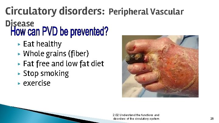 Circulatory disorders: Peripheral Vascular Disease ▶ ▶ ▶ Eat healthy Whole grains (fiber) Fat