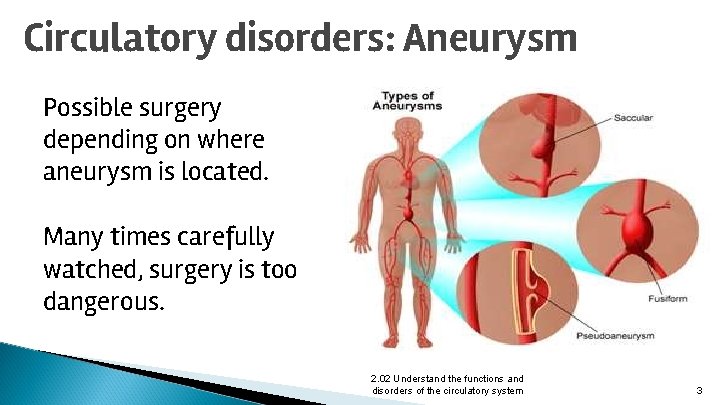 Circulatory disorders: Aneurysm Possible surgery depending on where aneurysm is located. Many times carefully