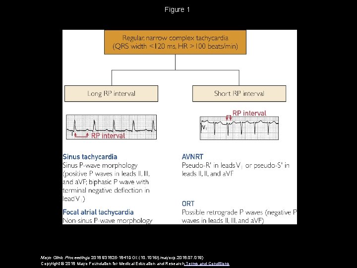 Figure 1 Mayo Clinic Proceedings 2018 931825 -1841 DOI: (10. 1016/j. mayocp. 2018. 07.