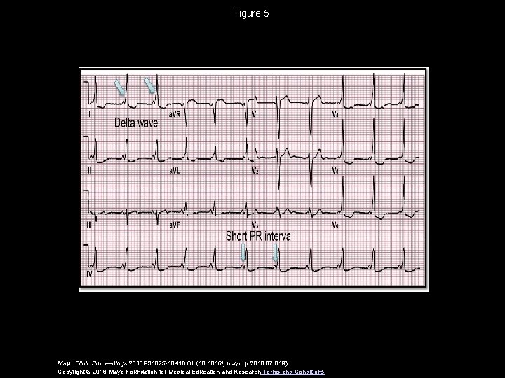 Figure 5 Mayo Clinic Proceedings 2018 931825 -1841 DOI: (10. 1016/j. mayocp. 2018. 07.