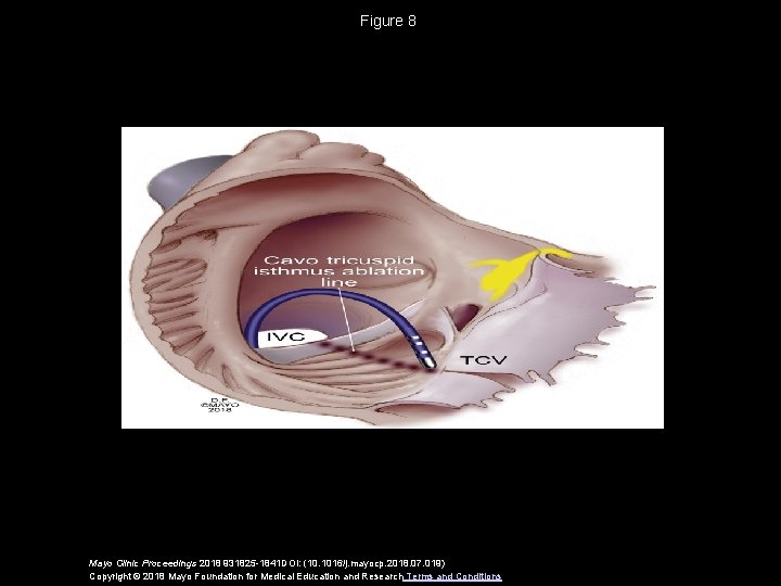 Figure 8 Mayo Clinic Proceedings 2018 931825 -1841 DOI: (10. 1016/j. mayocp. 2018. 07.