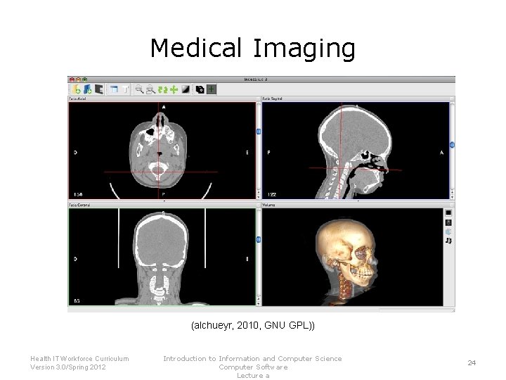Medical Imaging (alchueyr, 2010, GNU GPL)) Health IT Workforce Curriculum Version 3. 0/Spring 2012