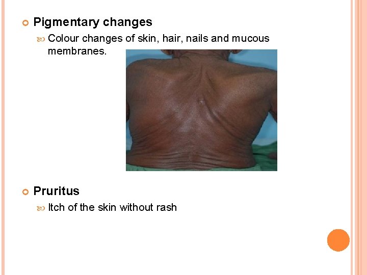  Pigmentary changes Colour changes of skin, hair, nails and mucous membranes. Pruritus Itch