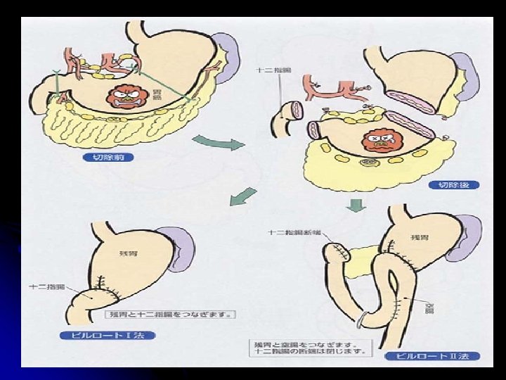 GASTROINTESTINAL STROMAL TUMORS Razvi Rasi HISTORY l l