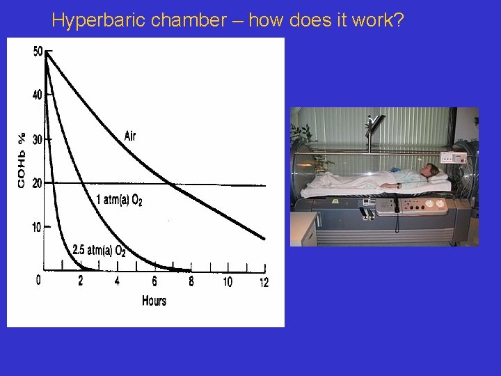 Hyperbaric chamber – how does it work? 