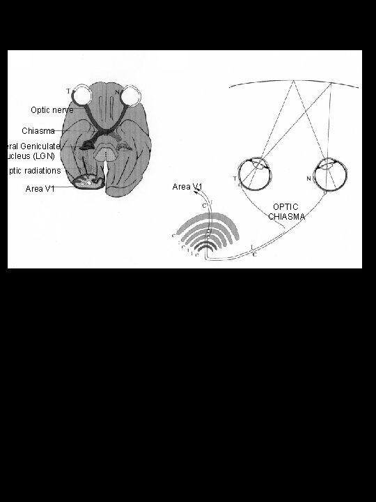 Optic nerve Chiasma ateral Geniculate Nucleus (LGN) Optic radiations Area V 1 OPTIC CHIASMA