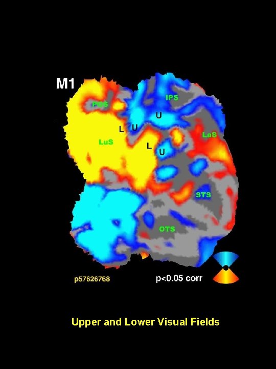 Upper and Lower Visual Fields 