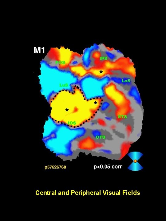 Central and Peripheral Visual Fields 