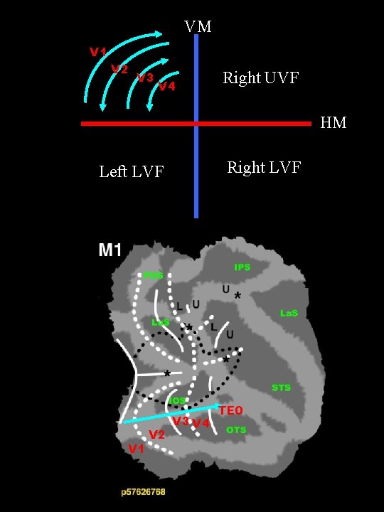 VM V 1 V 2 V 3 V 4 Right UVF HM Right LVF