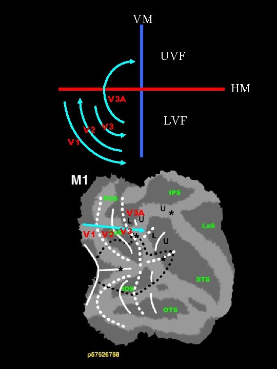 VM UVF HM V 3 A LVF V 2 V 3 V 1 V