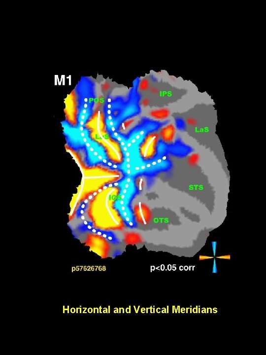 Horizontal and Vertical Meridians 