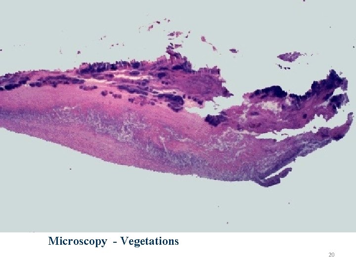 Microscopy - Vegetations 20 