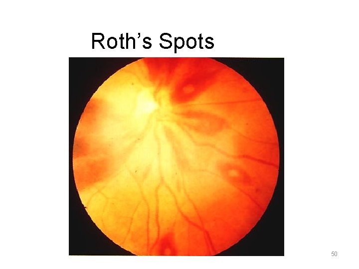 Roth’s Spots 50 