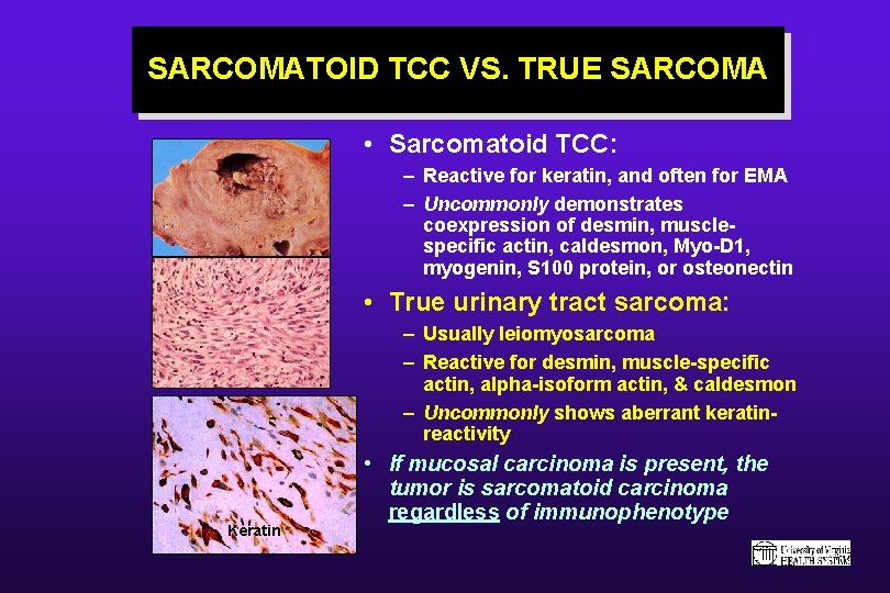 final stages of mesothelioma