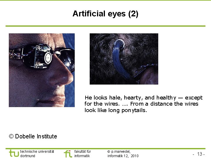 TU Dortmund Artificial eyes (2) He looks hale, hearty, and healthy — except for