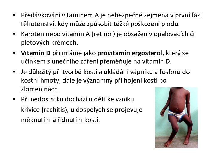 • Předávkování vitaminem A je nebezpečné zejména v první fázi těhotenství, kdy může • Předávkování vitaminem A je nebezpečné zejména v první fázi těhotenství, kdy může