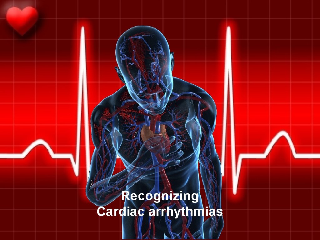 Recognizing Cardiac arrhythmias 