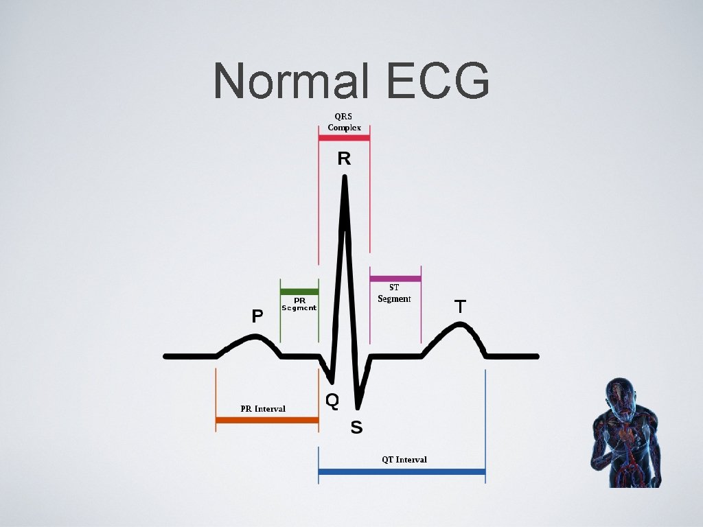 Normal ECG 