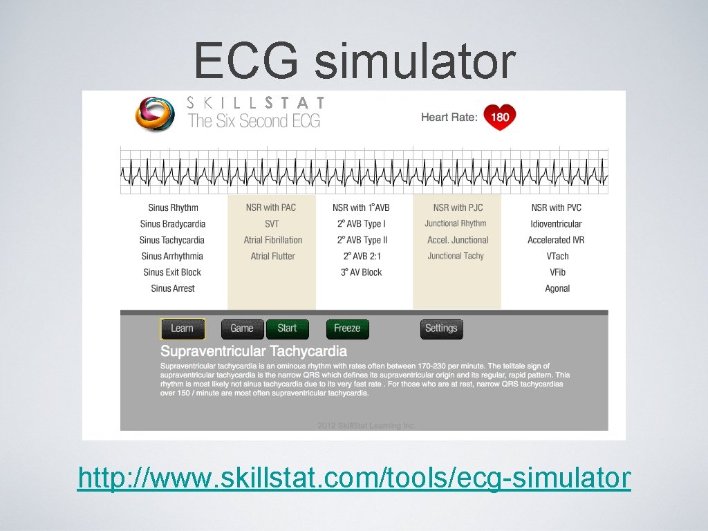 ECG simulator http: //www. skillstat. com/tools/ecg-simulator 
