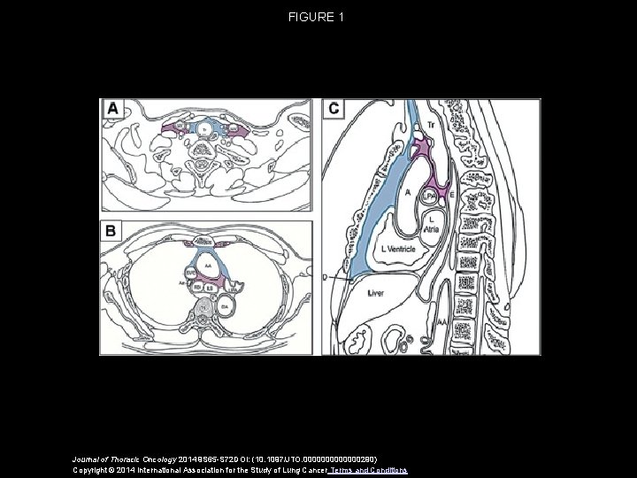 FIGURE 1 Journal of Thoracic Oncology 2014 9 S 65 -S 72 DOI: (10.