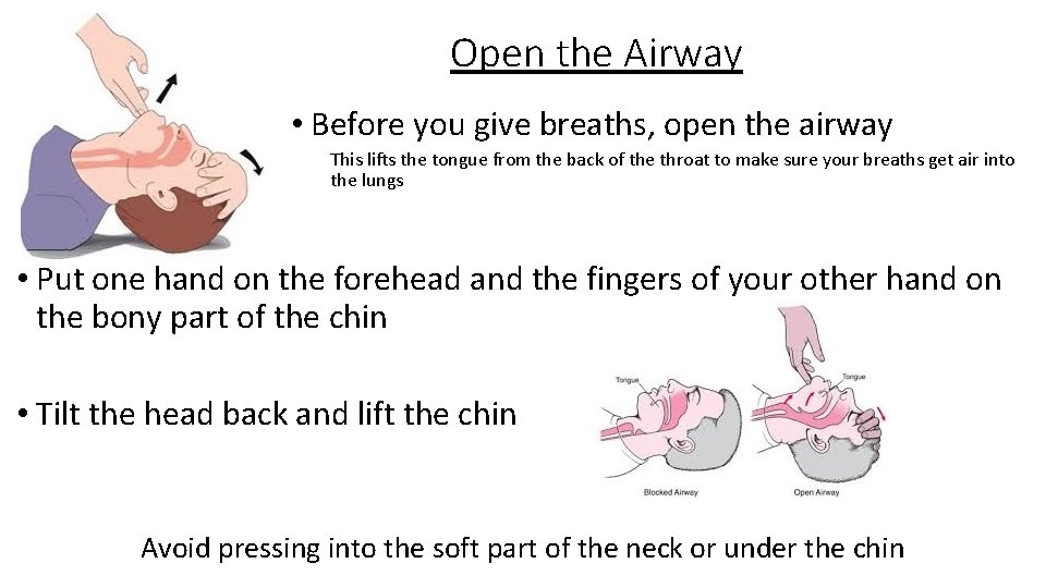 Open the Airway • Before you give breaths, open the airway This lifts the