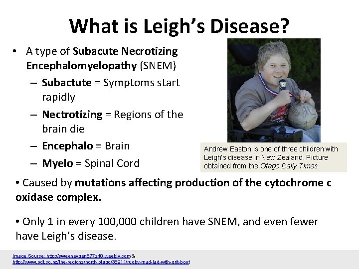 What is Leigh’s Disease? • A type of Subacute Necrotizing Encephalomyelopathy (SNEM) – Subactute