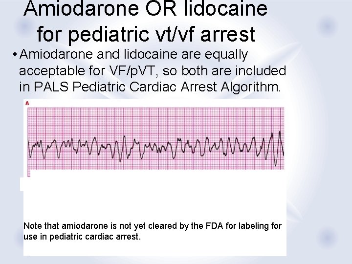 Amiodarone OR lidocaine for pediatric vt/vf arrest • Amiodarone and lidocaine are equally acceptable