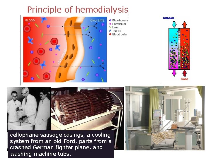 Principle of hemodialysis cellophane sausage casings, a cooling system from an old Ford, parts