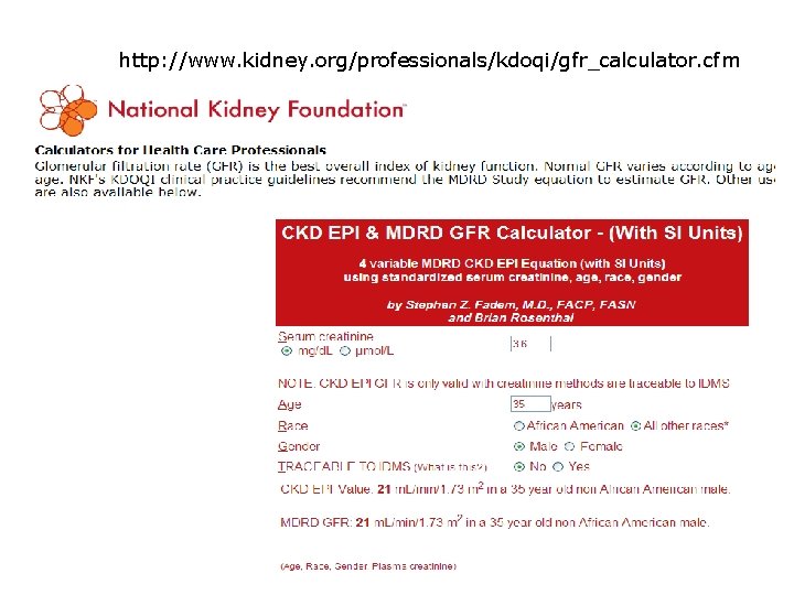 http: //www. kidney. org/professionals/kdoqi/gfr_calculator. cfm 