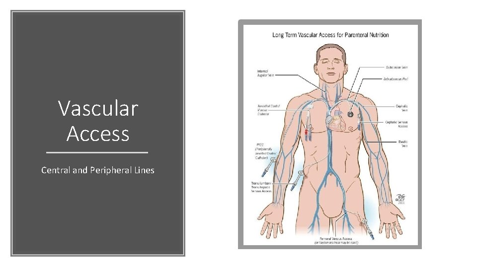 Vascular Access Central and Peripheral Lines 
