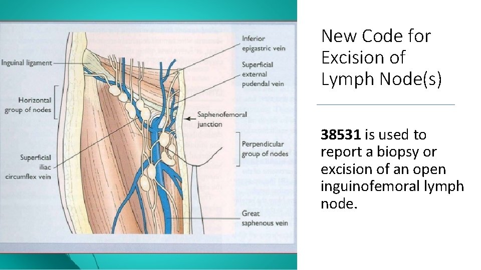 New Code for Excision of Lymph Node(s) 38531 is used to report a biopsy