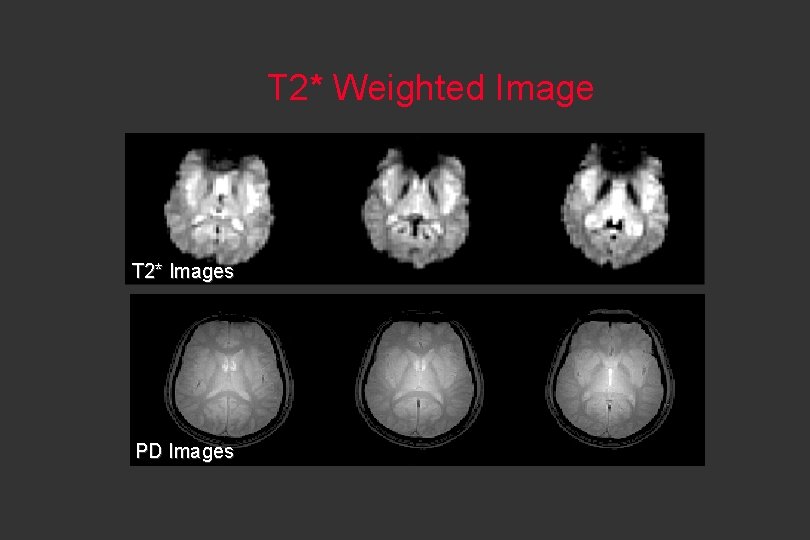 T 2* Weighted Image T 2* Images PD Images 