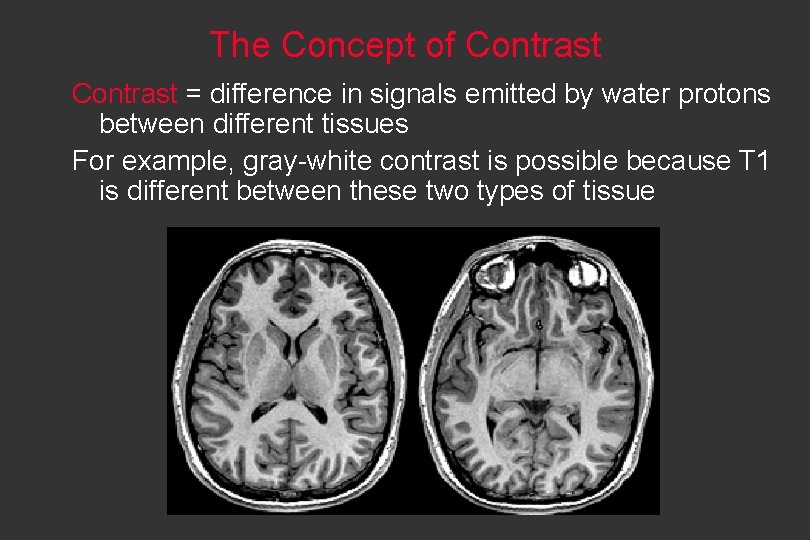 The Concept of Contrast = difference in signals emitted by water protons between different
