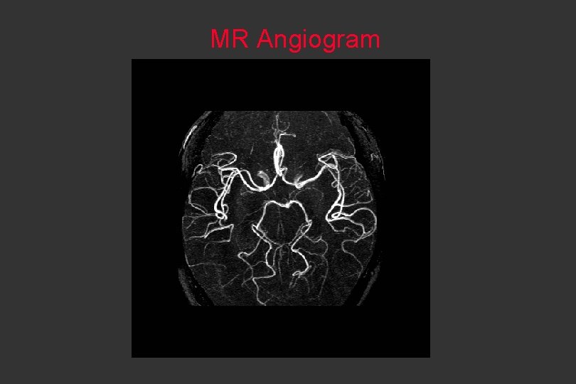 MR Angiogram 