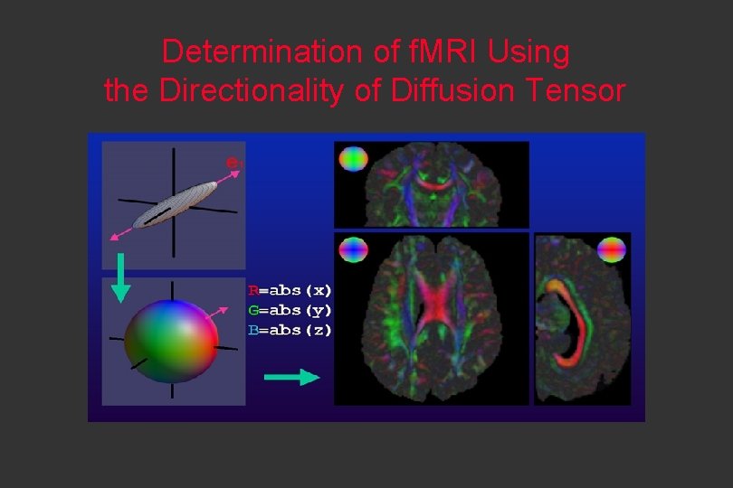 Determination of f. MRI Using the Directionality of Diffusion Tensor 