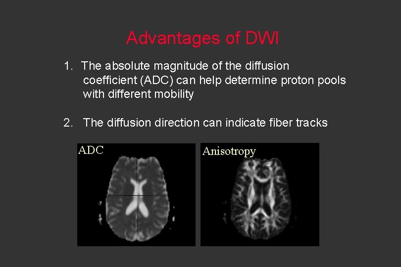 Advantages of DWI 1. The absolute magnitude of the diffusion coefficient (ADC) can help