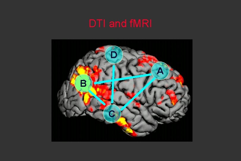 DTI and f. MRI D A B C 