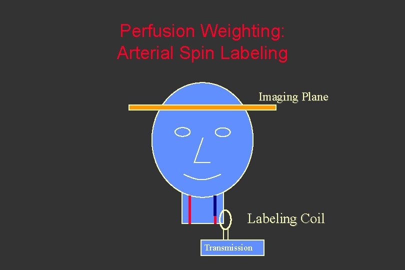 Perfusion Weighting: Arterial Spin Labeling Imaging Plane Labeling Coil Transmission 