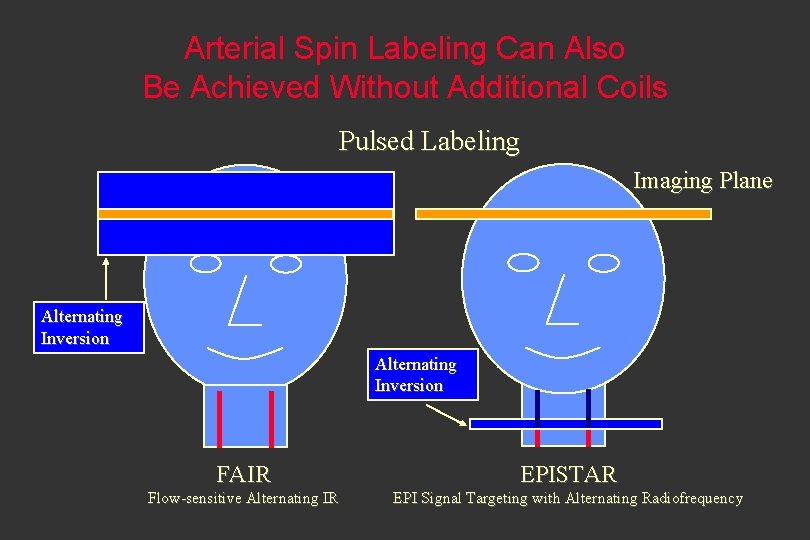 Arterial Spin Labeling Can Also Be Achieved Without Additional Coils Pulsed Labeling Imaging Plane